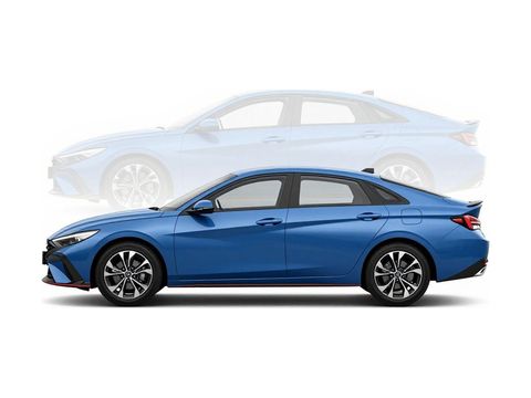 2024 Hyundai ELANTRA SEL Photo